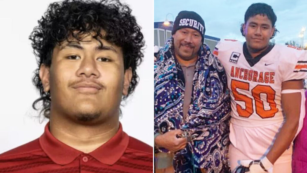Washington State football player is recovering after being shot by a UW student